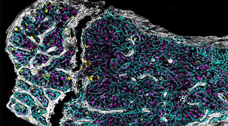 How old is your bone marrow?