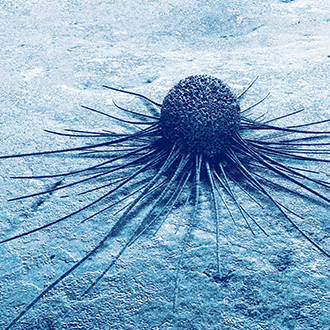 MTB Article - Page Tile