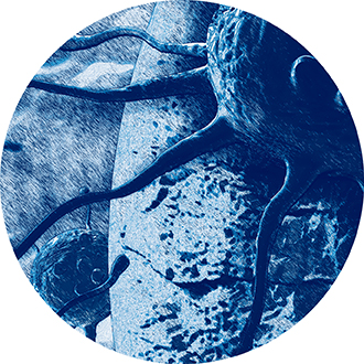 Onco-Hu® - Page Tile